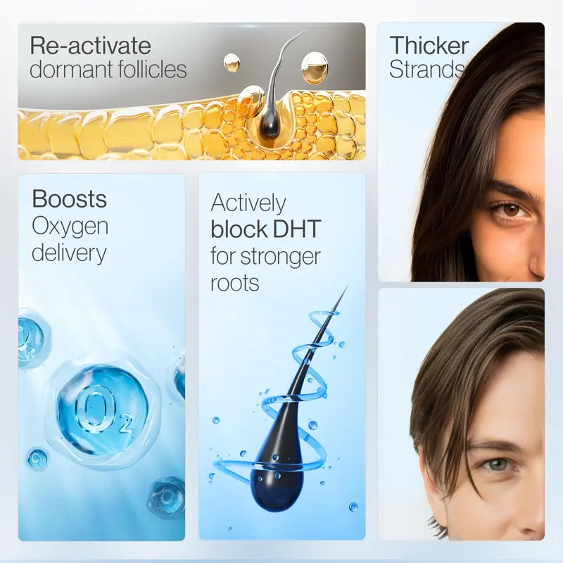 Be Bodywise Hair Growth Roll-On Serum, 3% Rosemary+ Redensyl & AnaGain, non-oily
