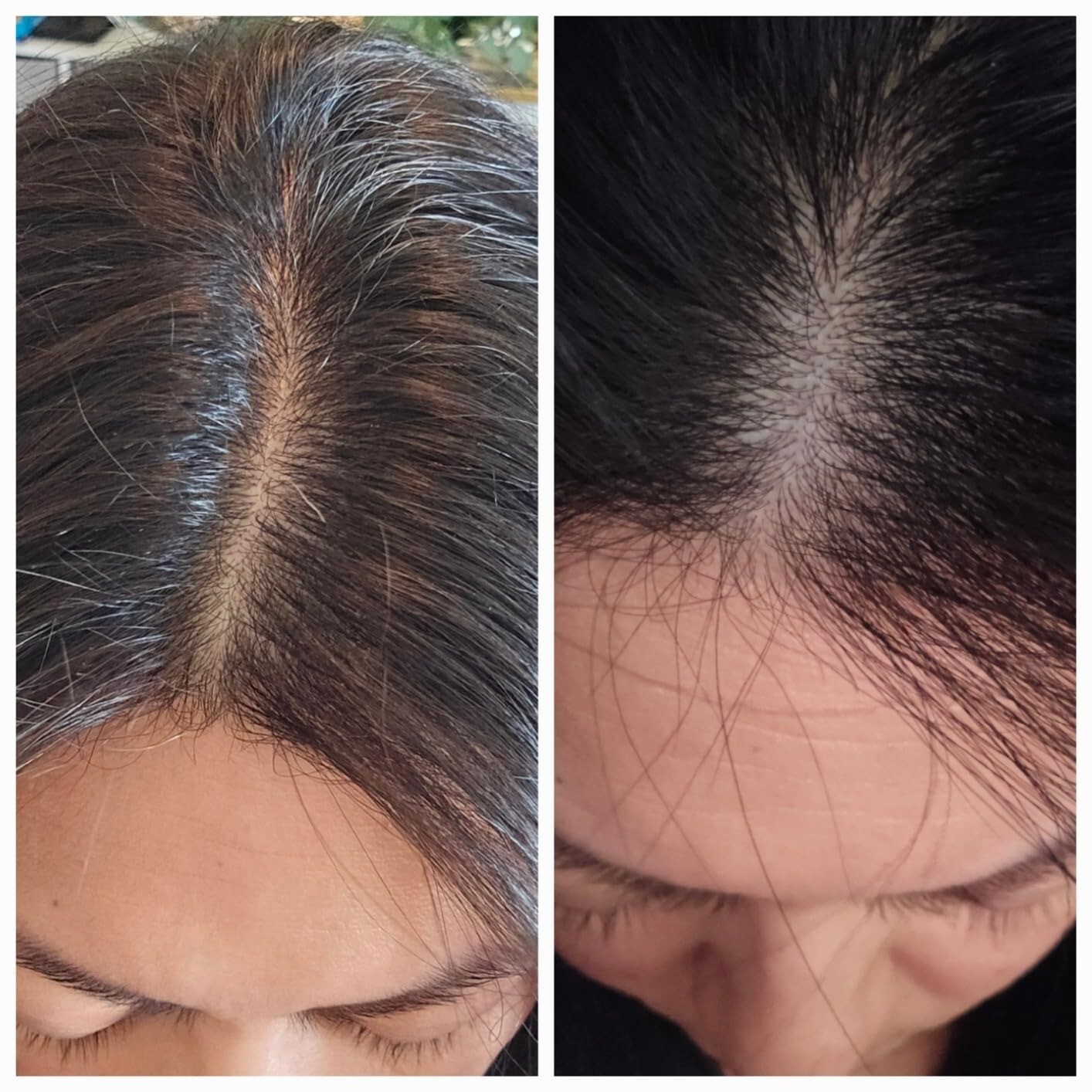 Hair La Vie Clinical Formula Hair Vitamins with Biotin & Saw PalmettoExp 04/2027