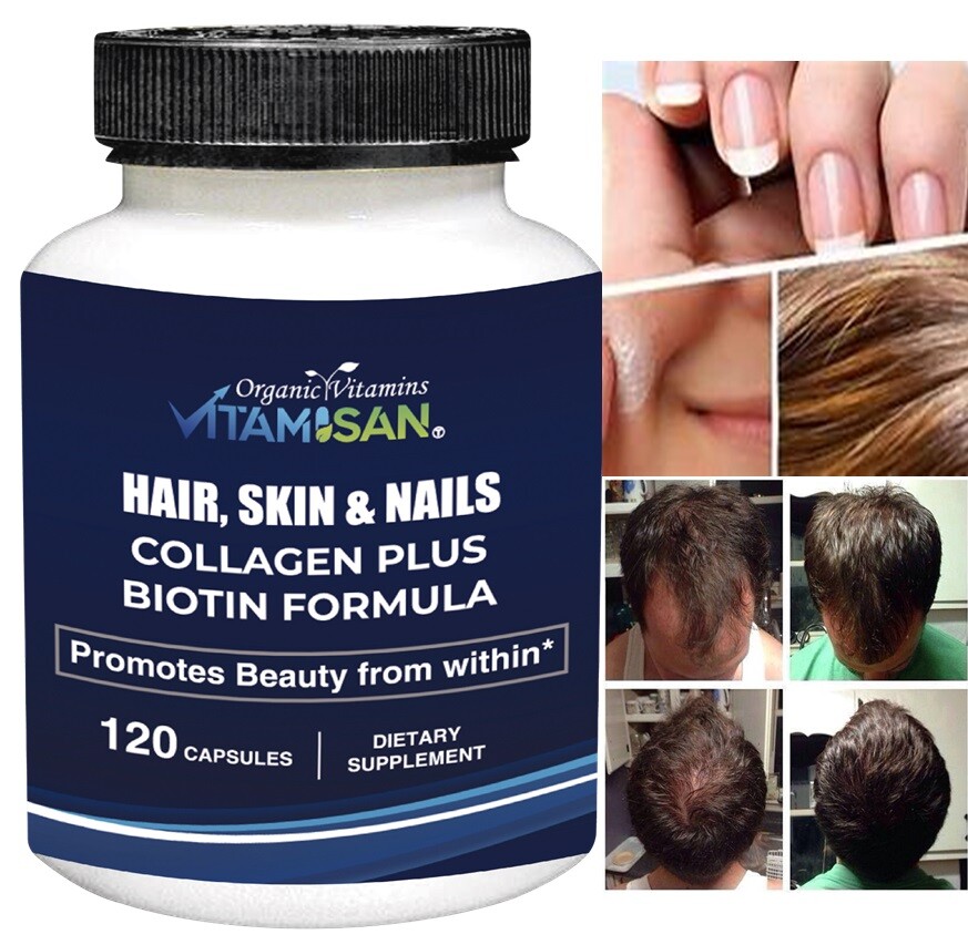 Hair Gain Biotin Hydrolyzed DHT Blocker Hair Growth Vitamins 2500000 Women Men