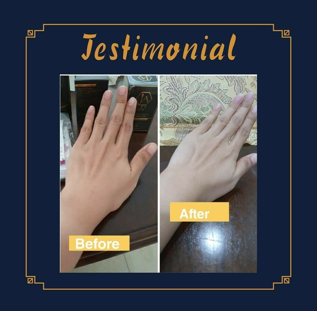 JAW 3.0 SKIN SUPPLEMENT