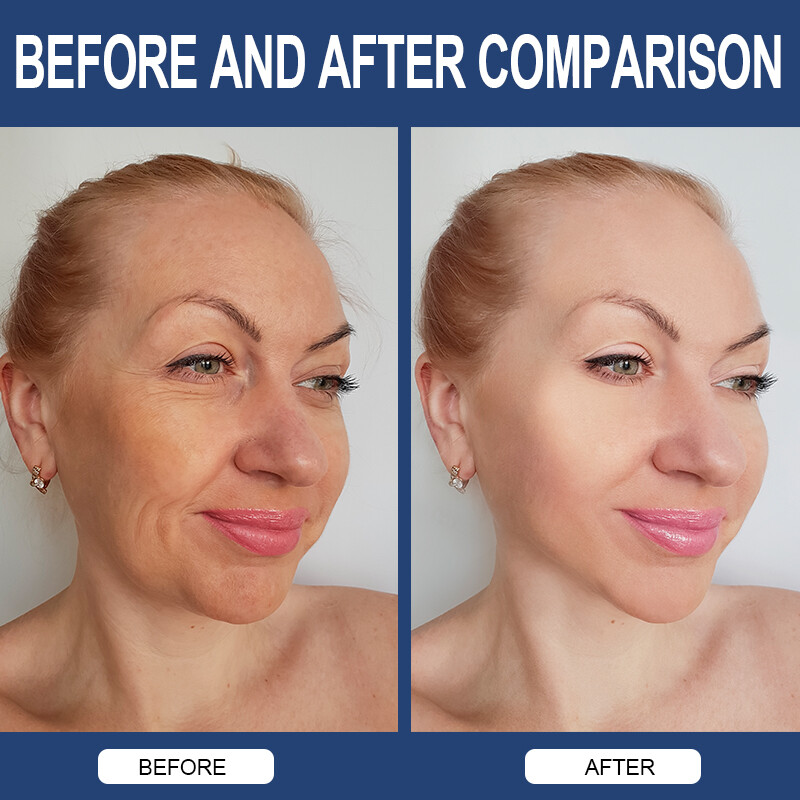 Hyaluronic Acid 30 mg of Vitamin C 850mg For Joint and Skin Health 240 Capsules
