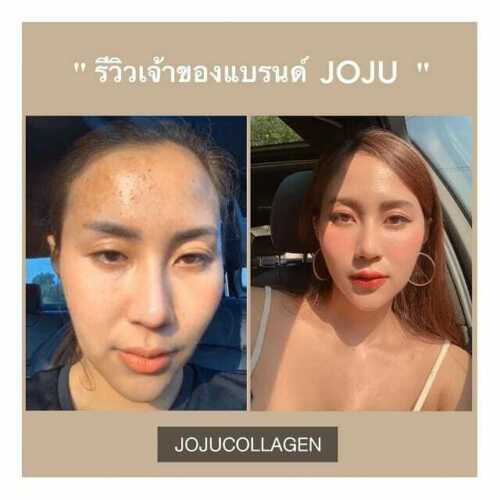 6X JOJU Collagen Dipeptide Reduce Acne Freckles Smooth Lightening Younger +Track
