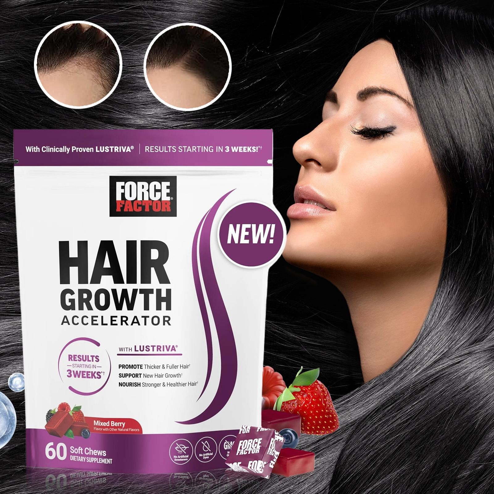 Factor FOKGE Hair Growth Accelerator Soft Chews, Hair Growth Vitamins For Women
