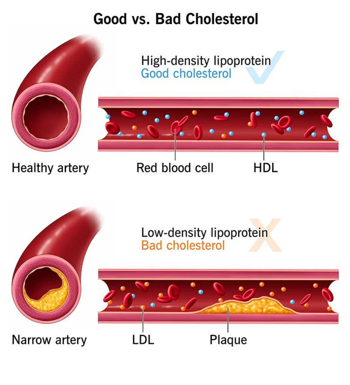 CHOLESTEROL BAD & HIGH TRIGLYCERIDES REMOVER & FLUSHER 90 PILL softgels