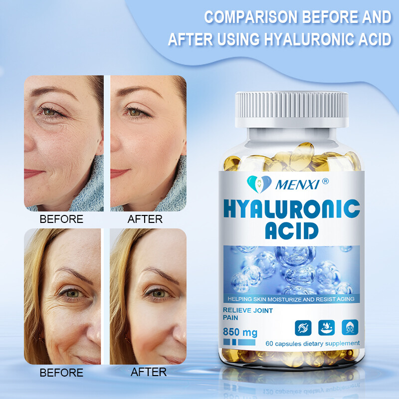 Hyaluronic Acid Anti Aging Hydrating Capsules Wrinkles Fine Lines Joint Health
