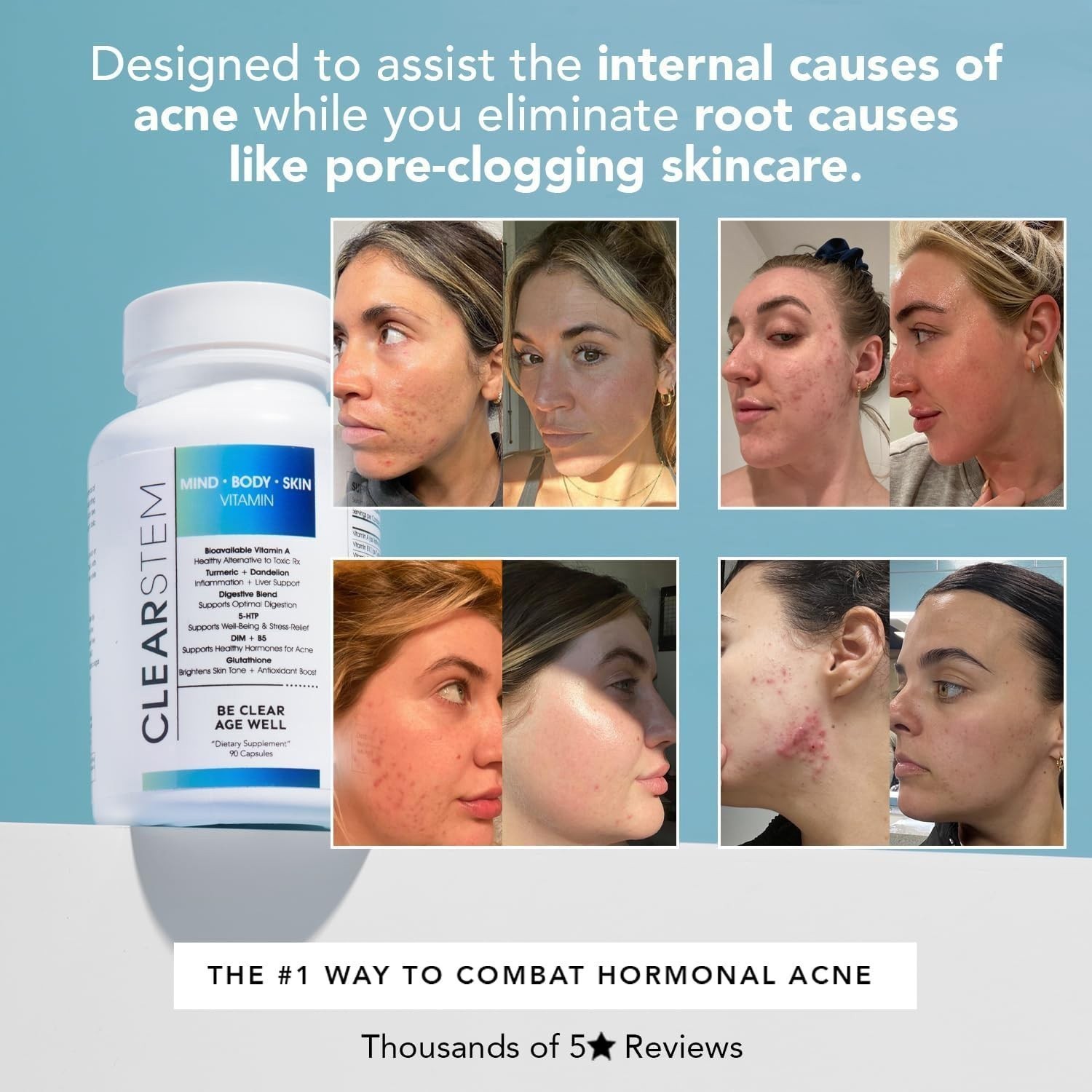 CLEARSTEM age acne 90 Softgels MIND BODY SKIN Vitamins Minerals Dietary