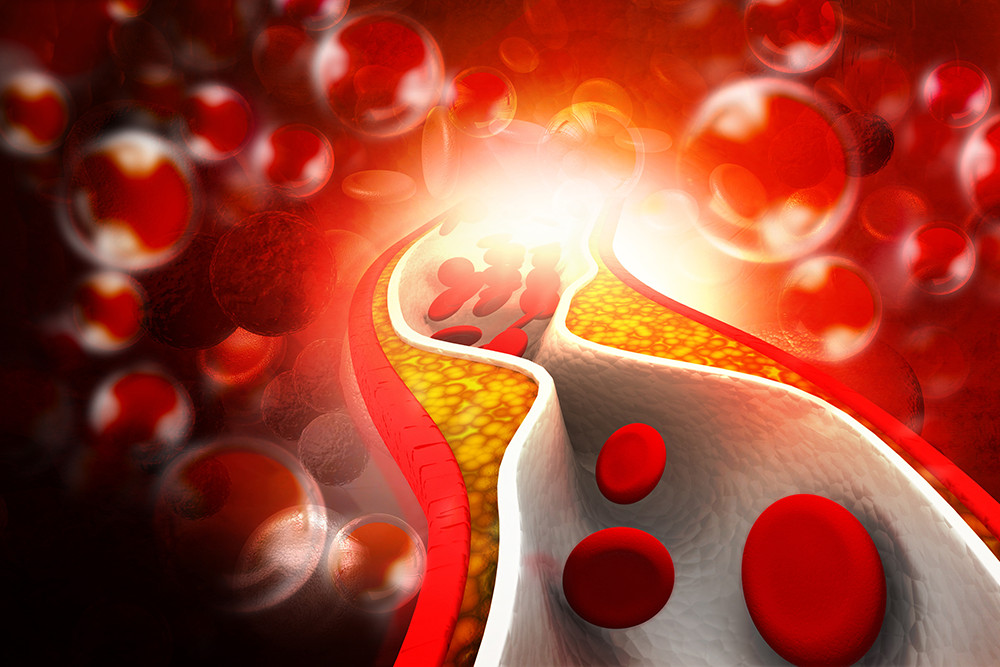 Blood pressure lowering – CHOLESTEROL RELIEF FORMULA – cholesterol balance – 1B