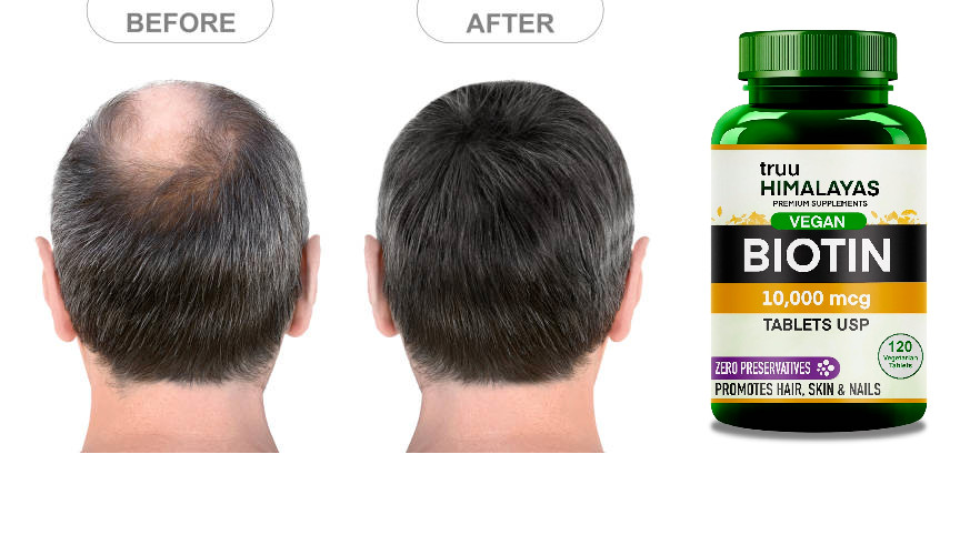 Vitamin B7 Biotin 10000mcg 120 Veg Tablets, Hair Growth, Skin & Nails Supplement