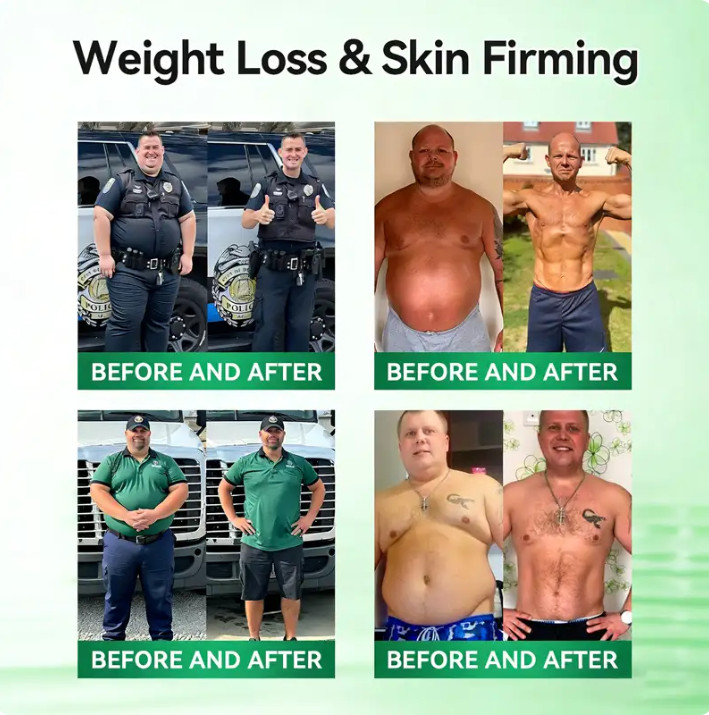 Moringa Moringa Berberine NAD+ Weight Loss Patches Advanced Nano Microneedle
