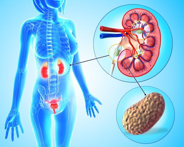Blood Purification – KIDNEY SUPPORT – Herbal Support 1 Bottle 60 Capsules