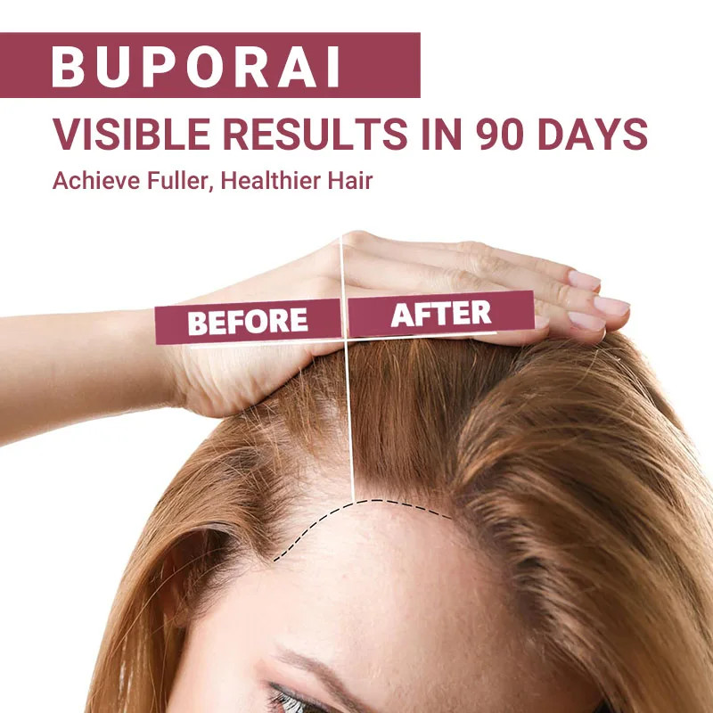 Hair Vitamin 120pcs – Reduce Hair Loss, Hair Quality, and Promote Healthy Growth